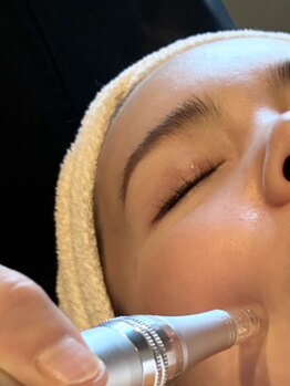 ホウレイ線・たるみ改善！予防ケア