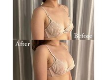 サロン ド ガーネット(Salon de Garnet)/一度の施術で感動のバストアップ