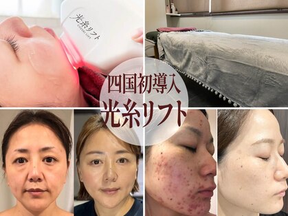 フェザード フレンズ 松山店の写真