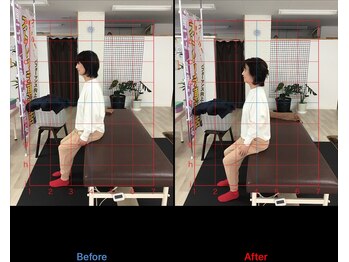 ストレチックス 近江八幡店/姿勢改善ビフォーアフター