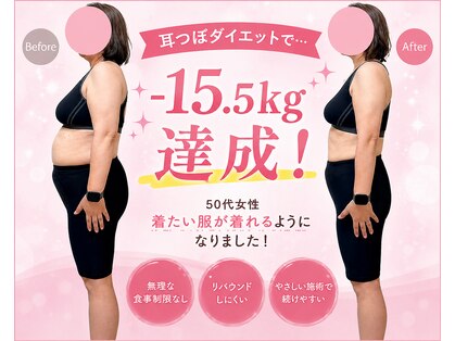 ア クイーユの写真