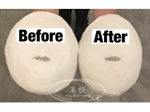 美極 トータルビューティー(美極 TOTAL BEAUTY)/恵比寿/小顔コルギ/エステ/