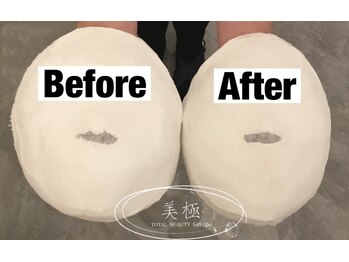 美極 トータルビューティー(美極 TOTAL BEAUTY)/恵比寿/小顔コルギ/エステ/