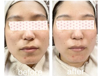 ラフレ(Rafre)/フェイスワックス