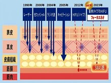 小顔/二の腕/くびれ等お悩みお任せください♪最新機器で解決♪