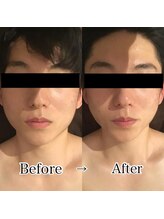 グレースフィオーレ 上野御徒町店(gracefiore)/ビフォーアフター