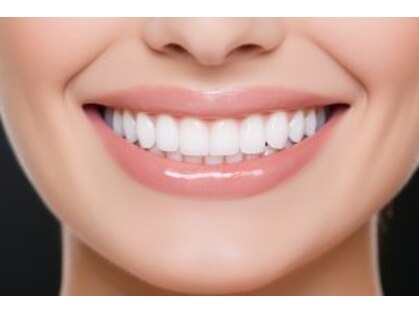 ラ カシェット(La Cachette)の写真