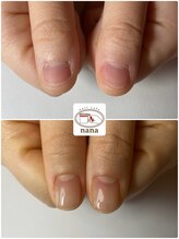 ネイルカフェ ナナ(nailcafe'nana)/自爪育成