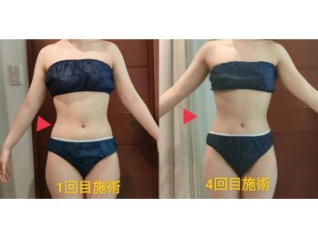 ビューティーエッセンス 都立大学(BEAUTY ESSENCE)/美骨盤&インディバ