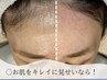 【初回限定】　フェイシャルWAX脱毛・鎮静保湿パック付　¥9500 90分