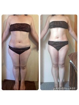 プレシャスサロン(precious salon)/4ヶ月でー10キロ達成のお客様