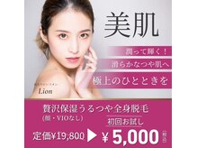 リオン 神戸三宮店(Lion)