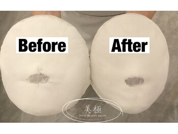 美極 トータルビューティー(美極 TOTAL BEAUTY)/恵比寿/小顔コルギ/エステ/