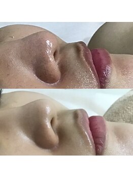 エヌエー(na)/乾燥肌・赤ら肌のお悩みに◎