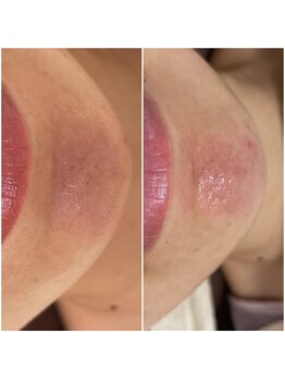 プアラ(puala)/シェービング