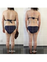 ボディメイクサロンアプローズ/背中細くなりました