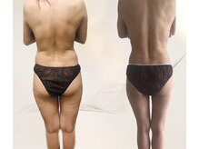 ヨサパーク グレイス(YOSA PARK Grace)/