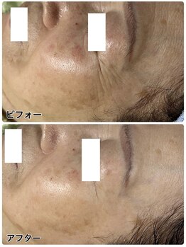 アンジェーム(angeame)/手強いおシワにもアプローチ♪