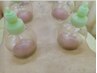 【日頃の疲れ改善に】痛みの少ないスライドカッピング+吸玉+滝汗2,980円