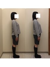 プリンセス バイ セイフティプリンセス 長野店(PRINCESS)/《猫背・反り腰に》全身矯正