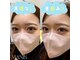 マニス(MANIS)の写真