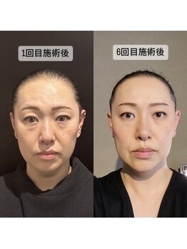 トゥインクル(Twinkle)/体重変わらずこんなに変わる?