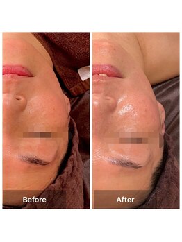 プライベートサロン アール(R)/コルギ（フェイシャル）