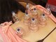 鍼灸オオクニ多肥(鍼灸okuni多肥)の写真