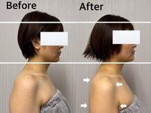 ベール(BEHL)/コルギのBefore After