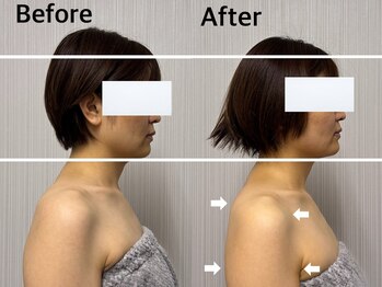 ベール(BEHL)/コルギのBefore After