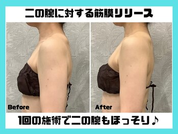 マーブル/上半身の筋膜リリース♪