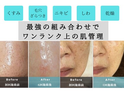 ル シェノン(Le Chainon)の写真