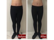 岩田整骨院美容整体院/【トランスビート】寝るだけ痩身