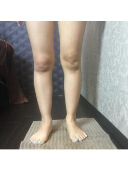 ボディインパクト プロデュース バイ アミカ(Body Impact produce by AMiCA)/◆The　SLIMコース◆