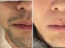 ミモア(mimoi.)/メンズ人気No.1！