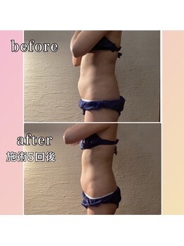 プリマジュール/【話題の痩身】圧倒的な変化