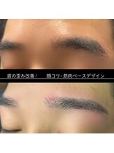 ブラックスワン(Black Swan)/眉の左右改善