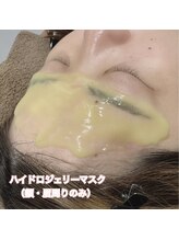 レディエント(Radiant)/ハイドロジェリーマスク