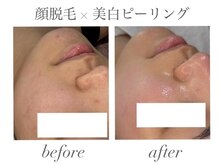 エミナル(EMINAL)