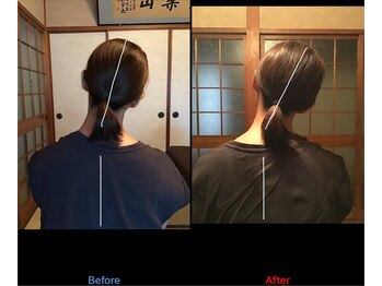 福岡いちふつうの整体院/寝起きの首の痛みの解消
