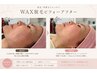 【艶肌】フェイシャルWAX|顔脱毛・毛穴・角質ケア