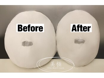 美極 トータルビューティー(美極 TOTAL BEAUTY)/恵比寿/小顔コルギ/エステ/