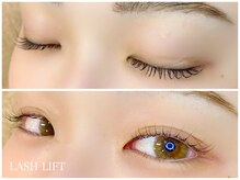 アイフェリス フェリス(I feliz×feliz)/ラッシュリフト(ファ-ビ-ロッド)