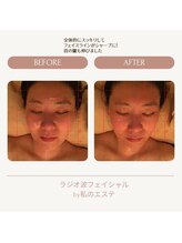 私のエステ 銀座/フェイシャルのメニューも豊富