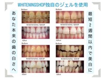 ホワイトニングショップ 大阪本町店/男性の方も大歓迎♪