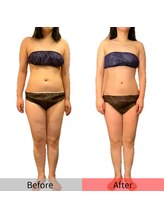 【－3.6kg】64.1→60.5kg☆エステで美しく痩せる近道◎