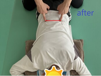 Kアプローチ三重桑名研究所 操整堂/施術後の画像(after)