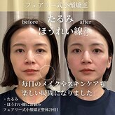 フェアリーフェイス 南森町店(Fairy Face)
