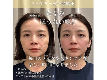 フェアリーフェイス 南森町店(Fairy Face)