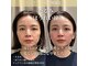 フェアリーフェイス 南森町店(Fairy Face)の写真